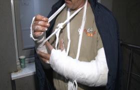 Caz ÎNSPĂIMÂNTĂTOR în Dâmbovița. Un tânăr i-a RUPT MÂINILE unei foste rude, de față cu toată familia. Camerele de supraveghere au înregistrat tot