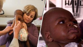 Caz INCREDIBIL! O fetiță care s-a născut cu PATRU PICIOARE a fost separată de geamănul ei parazit printr-o operație de şase ore (VIDEO)