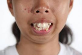 Transformare FANTASTICĂ a unei tinere, în urma operaţiilor estetice! Apropiaţii nici NU AU RECUNOSCUT-O! Rezultatul este unul cu adevărat ULUITOR