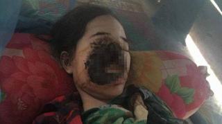 MUTILATĂ în urma unei banale vizite la dentist! O parte din chip i-a fost efectiv MĂCINATĂ!