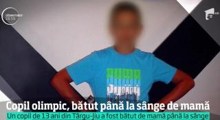 Şoc şi groază la Târgu Jiu! După ce a văzut raportul medico legal, Protecţia Copilului a cerut să ia URGENT copilul, bătut de mama sa pentru că nu era suficient de olimpic (VIDEO)