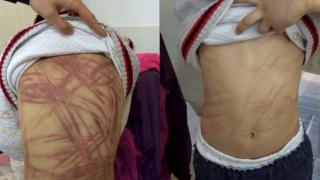 Suferință GROAZNICĂ pentru un copil din Bihor. Profesorii au descoperit GROZĂVIA abia când copilul a venit la școală în pantaloni scurți