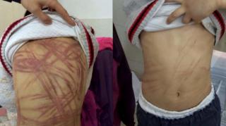 Autorităţile din Bihor au demarat o ANCHETĂ în cazul COPILULUI BICIUIT fără milă de concubinul mamei