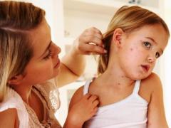 Epidemia de rujeolă "accelerează nevoia de măsuri legislative privind vaccinarea"