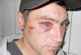 Samuraiul din Vâlcele a lovit din nou. De această dată, era să-l lase orb pe un consătean care mergea liniștit, spre casă. Atacatorul a încercat să-și facă harachiri