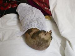 TULBURĂTOR! O fetiță de numai 12 ani se transformă încet-încet într-un "OM-COPAC". Imagini cutremurătoare (FOTO)