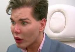 Păpuşa KEN are probleme mari! Tânărul care şi-a făcut zeci de operaţii estetice pentru un trup perfect, ar putea rămâne FĂRĂ NAS în orice moment!