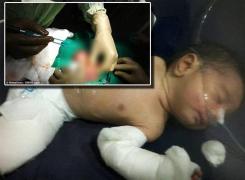 Scene incredibile în sala de naşteri! Un copil s-a născut... însărcinat - GALERIE FOTO