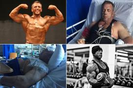 Culturismul salvează vieţi. Un campion a supravieţuit inexplicabil celei mai grave infecţii văzute de medici, datorită masei musculare impresionante