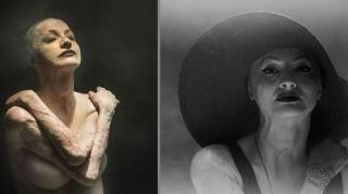 Tedy Ursuleanu are o nouă înfățișare! Tânăra mutilată de incendiul din Colectiv și-a făcut implant de păr (FOTO)