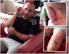 DESFIGURAT de jandarmi în sediul Poliţiei! L-au încãtuşat, legat de calorifer şi LOVIT CU SĂLBĂTICIE pânã a fãcut pe el. Totul, sub privirile copiilor! (VIDEO)