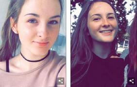 Răzbunare cruntă din gelozie! O tânără de 18 ani a fost MUTILATĂ pe viață, după ce o colegă i-a pus acid sulfuric în instrumentul muzical