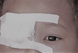 GROAZNIC! Copil de cinci ani, la Urgenţă, ÎNŢEPAT cu CUŢITUL în OCHI! "I s-a facut tot ce se poate, dar e prea târziu". Cazul oribil care a ÎNGROZIT-O pe şefa Spitalului Clinic de Urgențe Oftalmologice București