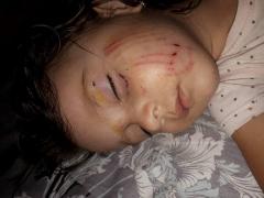 O fetiţă de doi ani a fost ATACATĂ de un câine în parc: 'Nu vă puteţi imagina cum arăta sufleţelul mic'