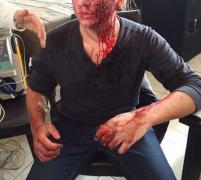 Scene SÂNGEROASE la târgul auto: 'Seif a primit un topor în cap şi s-a umplut de sânge!'