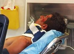 Un elev de liceu a ajuns la spital cu faţa TUMEFIATĂ după ce a refuzat AVANSURILE unei COLEGE de clasă!