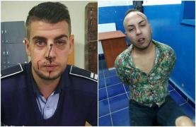 Poliţist SNOPIT ÎN BĂTAIE de un şofer băut! Tânărul de 25 de ani l-a UMPLUT DE SÂNGE pe agent, după ce a fost testat cu aparatul etilotest (GALERIE FOTO)