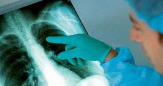 ALERTĂ MEDICALĂ la şcoala din Roşiori! Numărul copiilor bolnavi de TUBERCULOZĂ a crescut la halucinanta cifră de 52! (VIDEO)