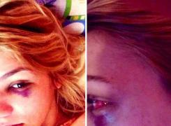 O tânără însărcinată în 5 luni a fost BĂTUTĂ cu SĂLBĂTICIE de soţul ei: 'Asta e 1% pe lângă tot ce îmi face!'