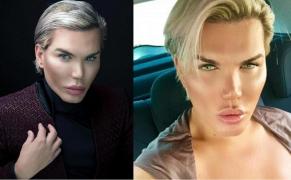 Păpușa umană Ken a ajuns din nou la doctor. Tânărul care și-a făcut deja 60 de operații și-a scos coastele (Foto, Video)