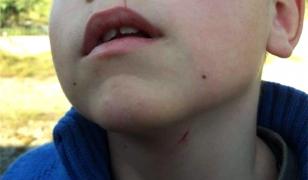 Un învăţător din Botoşani a strâns de gât un elev până l-a lăsat fără aer