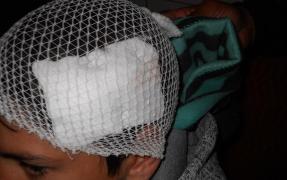 Copil de 9 ani scalpat cu sapa de un vecin, pentru 10 lei