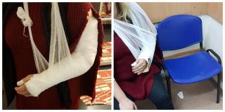 Mâna ruptă a unei femei a fost fixată de medicii din Cluj cu o bucată de carton