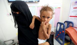 85.000 de copii au murit de foame, în ultimii trei ani, din cauza războiului din Yemen