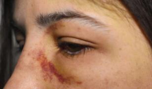 Mama fetei băute de iubitul violent la Ploieşti: 'Ne-a spart geamurile la casă'