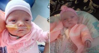 Fetița născută prematur în Marea Britanie