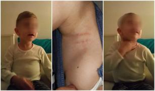 Băiețel de trei ani din Focșani, traumatizat de educatoare. Femeia l-a strâns de gât și de organul genital pentru că nu-și făcea nevoile