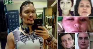 Operații estetice nereușite