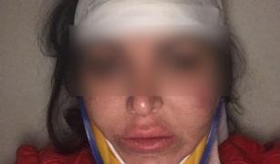 Primele declaraţii ale tinerei bătute de iubit într-o spălătorie