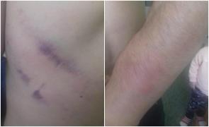 Un tânăr de 28 de ani din Ocna Mureș acuză un poliţist că l-a bătut până i-a rupt 2 coaste, băgându-l în spital