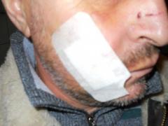 Amantul unei femei din Dej, dispus să ucidă pentru dragostea ei. Soţul femeii, atacat cu cuţitul