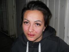 Scene de groază pe o stradă din Cluj. O tânără a fost desfigurată de fostul de iubit: 'Nu voi scăpa de răzbunarea lui'