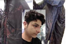 Elev român, bătut până la sânge de mai mulți colegi de clasă în Manchester. Reacția Ambasadei României la Londra