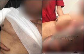 Incident șocant în Baia Mare! Un tânăr a fost înjunghiat de un bărbat în fața unui club de manele. Agresorul e căutat de polițiști