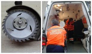 Medicii au rămas muţi. La Urgenţe a venit un pacient care încercase să-şi taie un neg de pe gât cu flexul