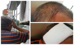 În loc să ajungă cu biletul la agenţia Loto, un arădean a ajuns la spital, cu capul spart