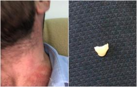 Șeful OPC Constanța, strâns de gât și înjurat în timpul unui control la o terasă din Neptun. Horia Constantinescu și-a pierdut un dinte (Video)