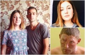 Caz înfiorător în Crimea. Băut şi orbit de gelozie, un bărbat şi-a incendiat iubita de 19 ani