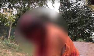 Bătrână din Constanța, desfigurată de câinele din gospodarie. Femeia a fost mușcată de față, de cap, de mâini