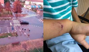 Copil de 5 ani, sfâşiat de câini maidanezi pe o stradă din Motru