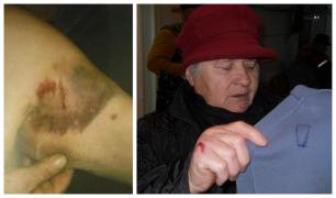 Înjunghiată în piept, o fostă şoferiţă de camion din Cluj s-a bătut cu 3 femei, care îi intraseră în casă, să o jefuiască