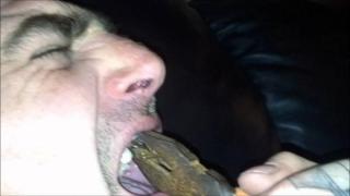 Un român a murit în Italia, după ce şi-a scos singur doi dinţi. Nu avea bani să meargă la dentist