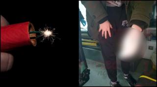 Distracție cu petarde în Vaslui, un tânăr a rămas fără un deget