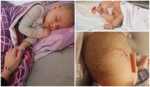 Anastasia a fost deja operată pe creier