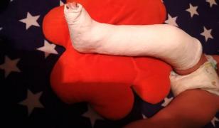 Copil cu un picior rupt, trimis acasă de o asistentă de la Spitalul de Pediatrie Ploieşti