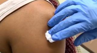 Noi cazuri de rujeolă confirmate în România